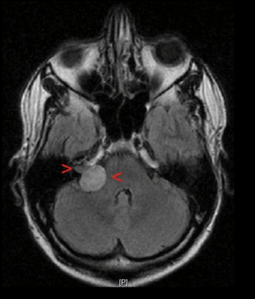 Картинка из википедии
