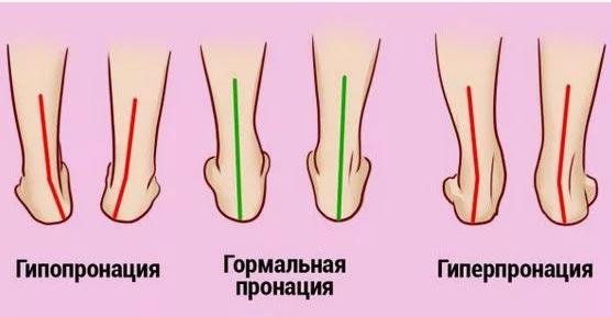 куда гнутся наши ноги