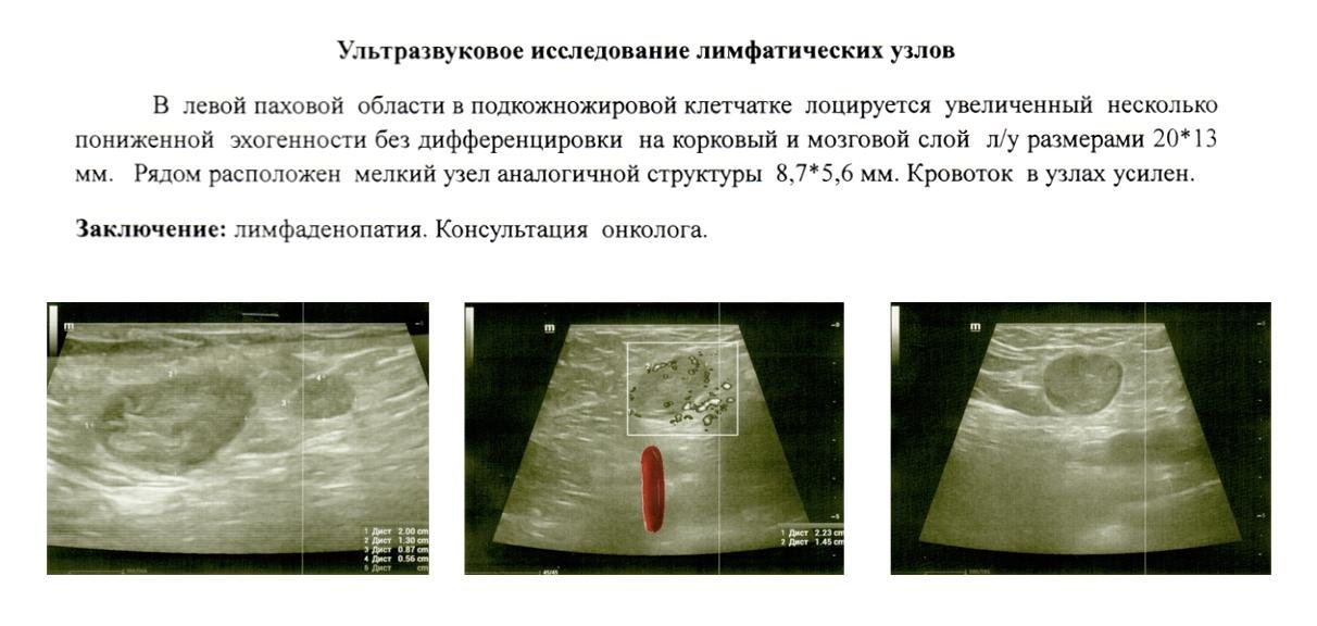 Заключение УЗИ